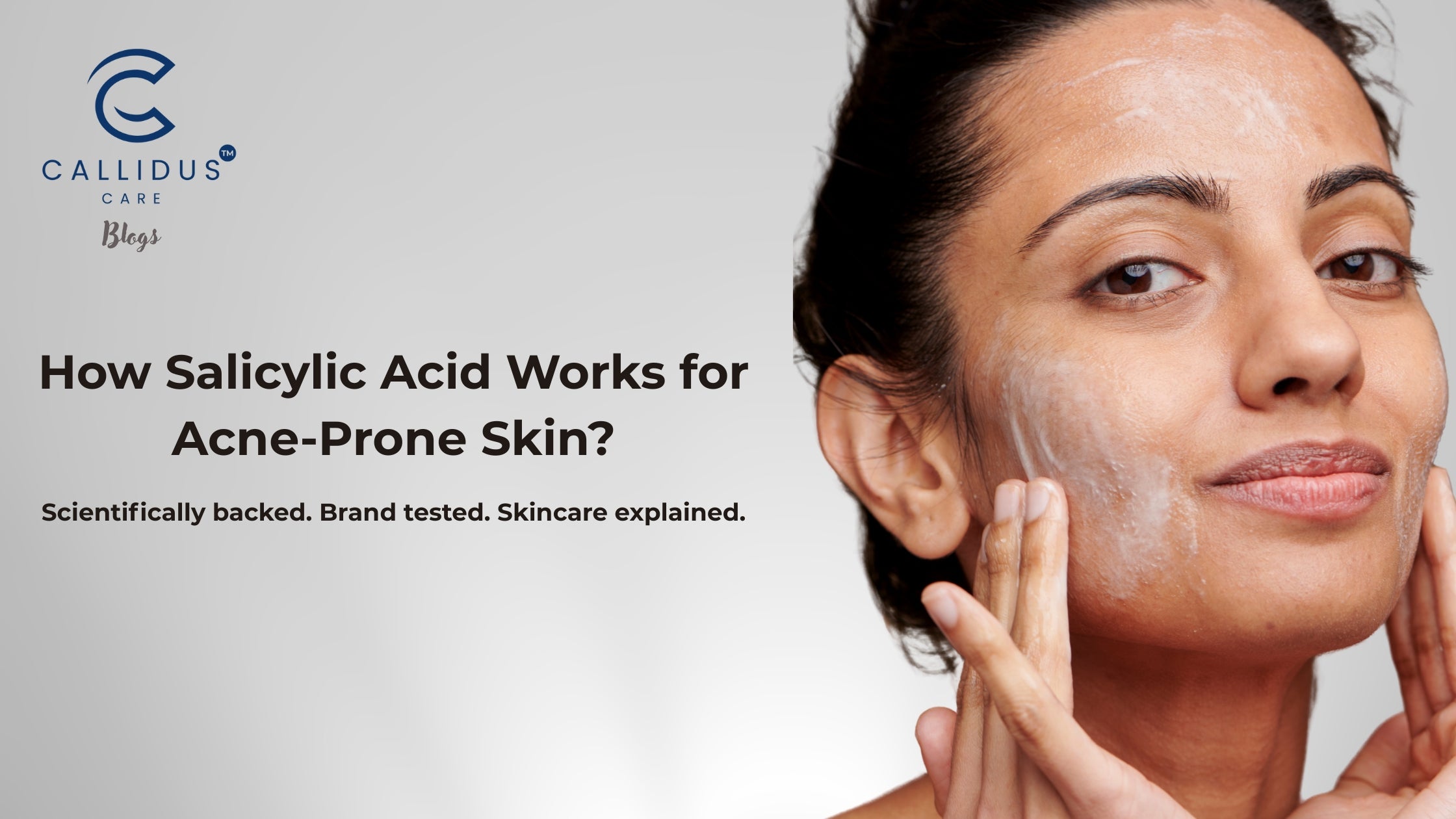 How Salicylic Acid Works for Acne-Prone Skin