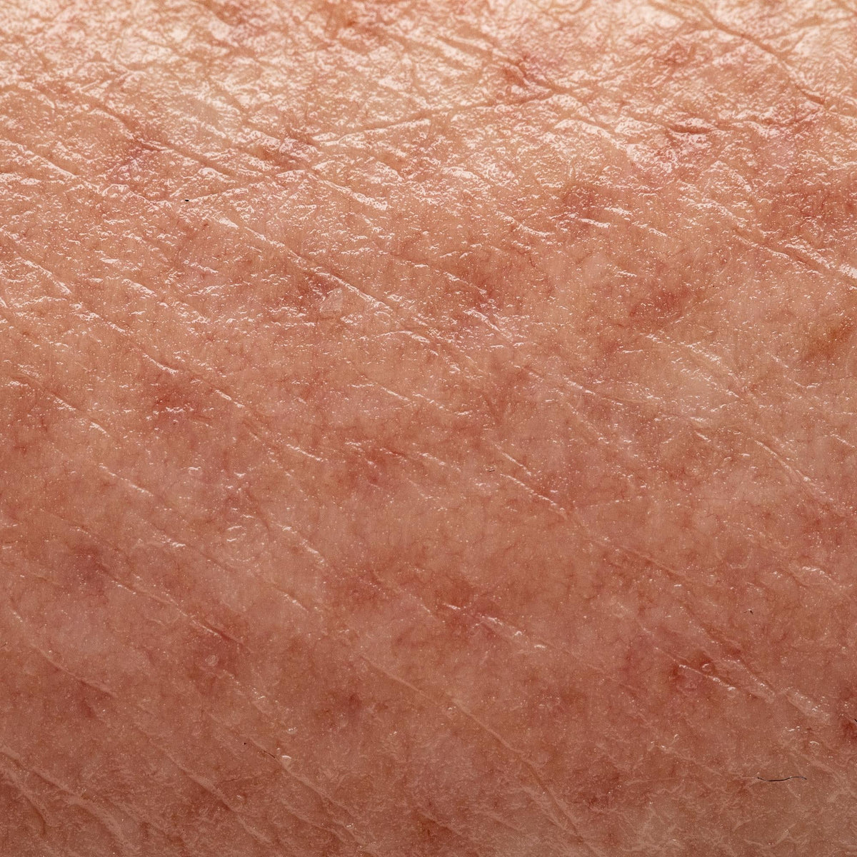 Dull & Pigmented Skin Care – Brightening & Pigmentation Treatment ...