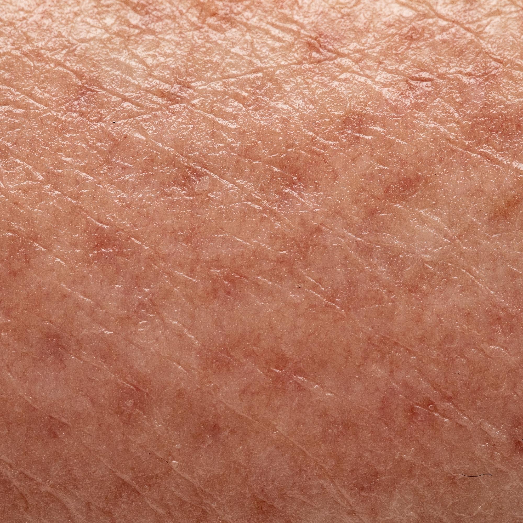 Dull & Pigmented Skin