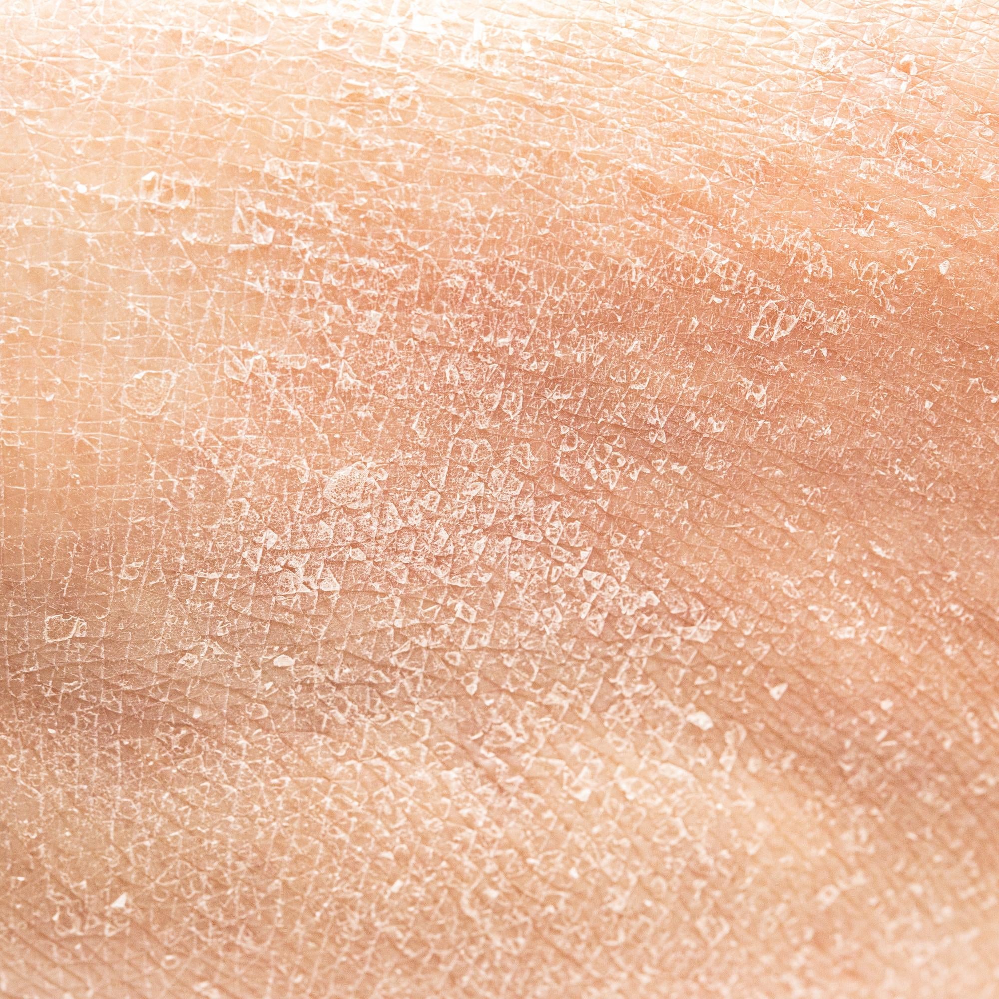 Dry & Sensitive Skin