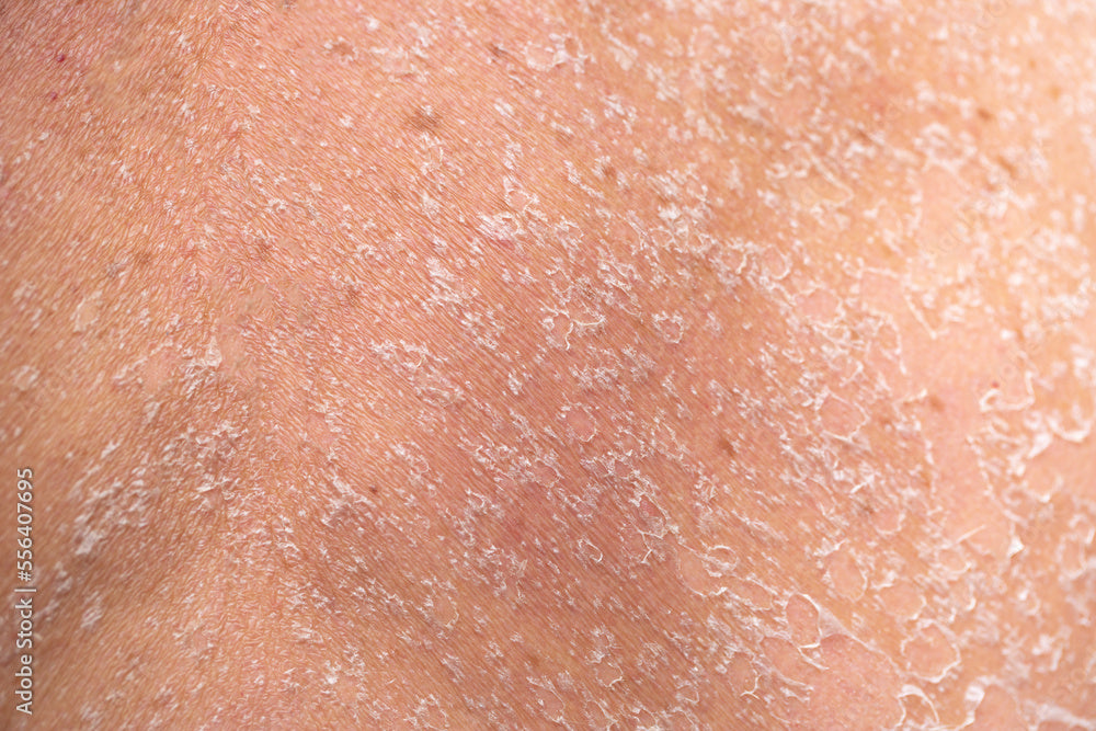 Dry & Sensitive Skin